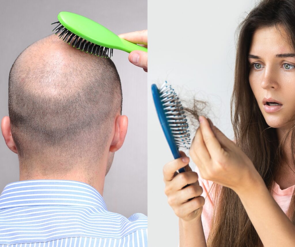 glow your looks hairfall Hair Loss in Men and Women: Reasons and Solutions